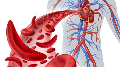 Penyakit Jantung dan Pembuluh Darah